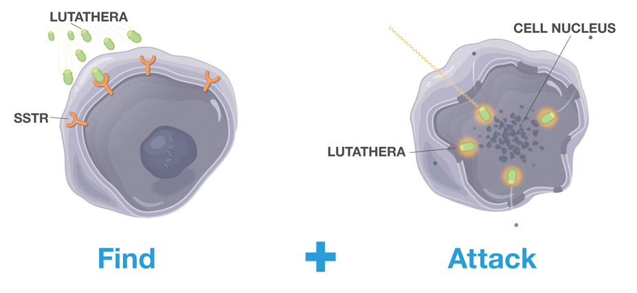Lutathera finds NET cells and attacks the cells with radiation.